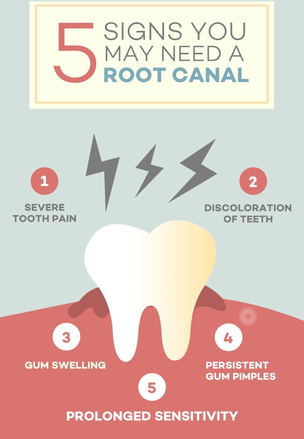 Root Canal - Severe Tooth Pain, Descoloration of Teeth, Gum Swelling, Persistent Gum Pimples, Prolonged Sensitivity
