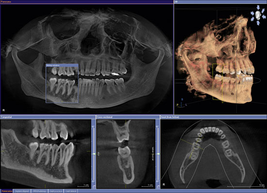 3-D X-Ray Scan